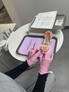Subgingival Cord Placement Course